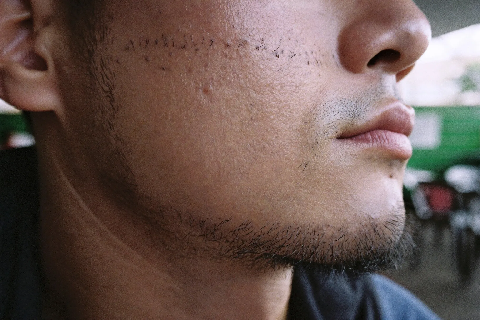 Close view of a man's jaw showing sparse cheek stubble and denser growth on the chin